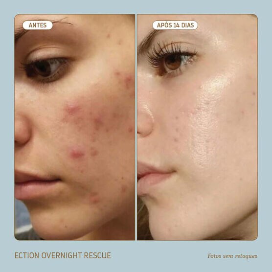 Hidratante Noturno Reparação Profunda Biossance SQUALANE ECTOIN OVERNIGHT RESCUE